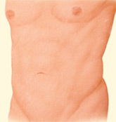 Torso problems, after