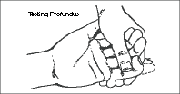 Figure2