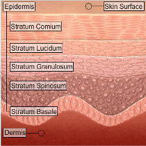 How Chemical Peel Works