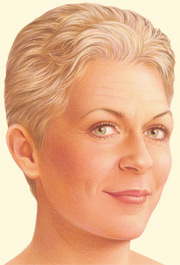 Jowls Plastic Surgery on Sagging Jowls Loose Neck Skin And Fat Accumulation Under The Chin May