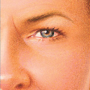 Laser Resurfacing, After