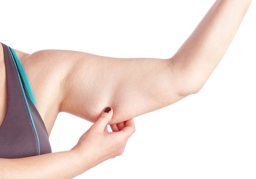 Arm Lift