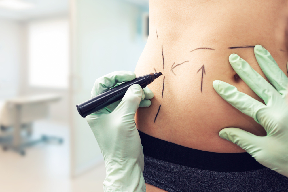 A variety of body contouring options offers customized treatments | ASPS