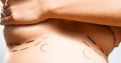 The four S's when considering breast augmentation