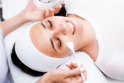 Everything you need to know about chemical peels