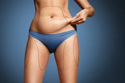 The skinny on CoolSculpting