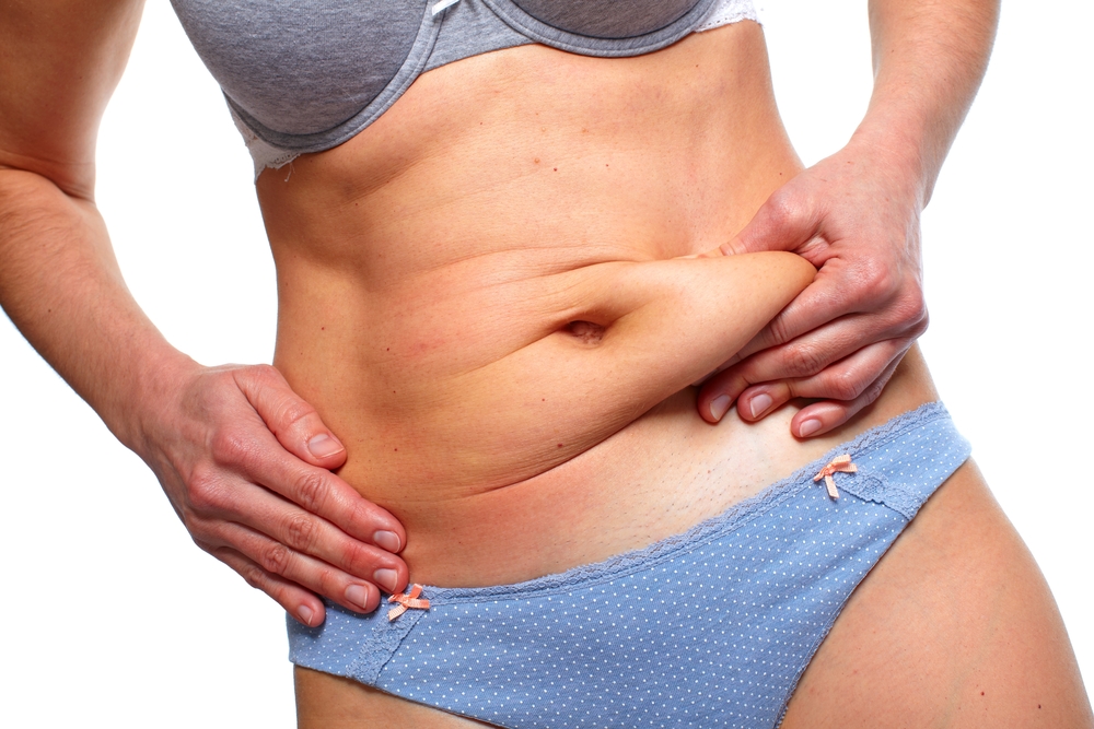 Tummy Tuck Revision Beverly Hills