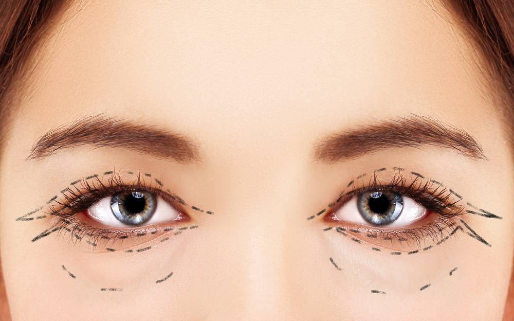 Best Eyelid Surgery (Blepharoplasty) - Plastic Surgeon in Toronto - Ford Plastic  Surgery