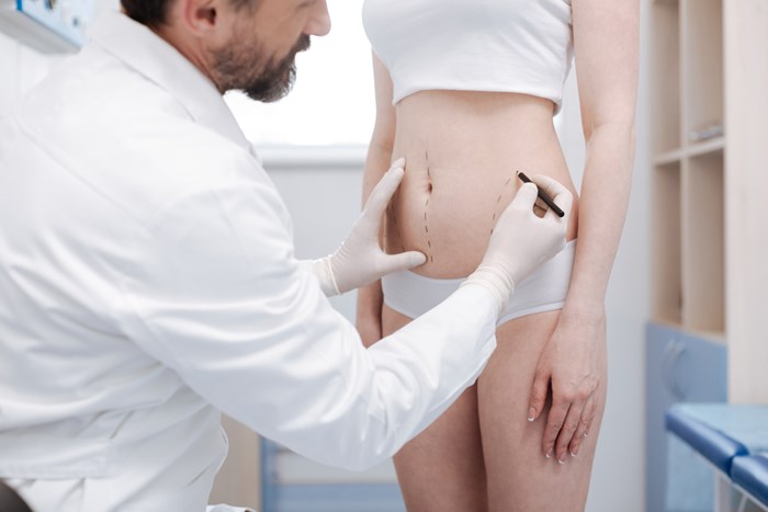 frequently asked liposuction questions