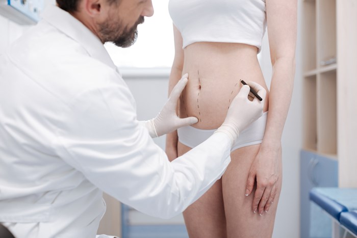 frequently asked liposuction questions frequently asked liposuction questions