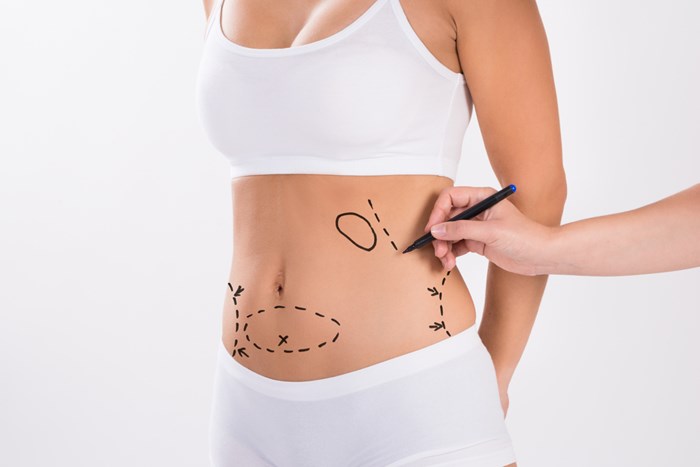 Ultrasonic liposuction vs traditional liposuction | ASPS