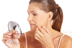 Want to restore aging skin? Try microneedling