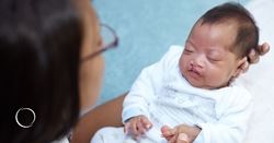 A parental guide to cleft lip and palate surgery