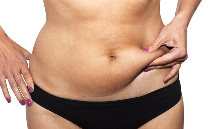 Panniculectomy vs. Tummy Tuck - What are the Key Differences