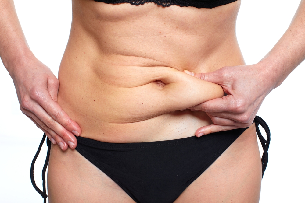 Tummy Tuck—Different Types