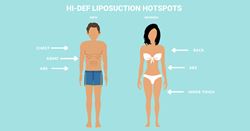 Body contouring's latest frontier: High-definition liposuction