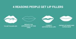 Four reasons a person may want lip filler