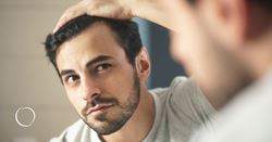The hair restoration revolution: Addressing male pattern baldness