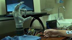 Plastic surgeons want to use nerve regeneration to make prosthetic limbs move