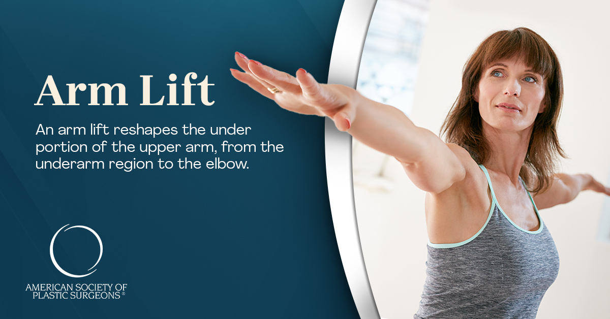 Arm Lift Cost | American Society of Plastic Surgeons