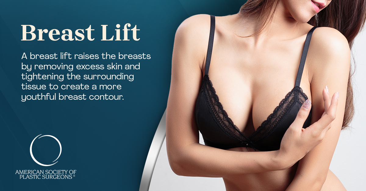 Breast Lift Recovery  American Society of Plastic Surgeons