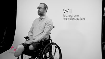 Resilience – Bilateral Arm Transplant Story