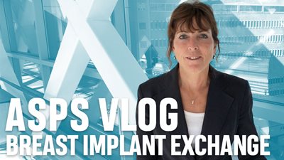 Breast Implant Exchange with Dr. Juliana Hansen