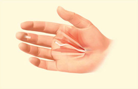 Treating Hand Trauma