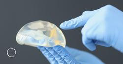 The top 10 things plastic surgeons want you to know about breast implants