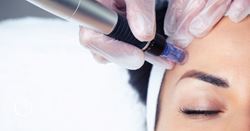 Collagen banking in your 30s? Here's everything you need to know