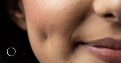 The ins and outs of creating dimples with plastic surgery