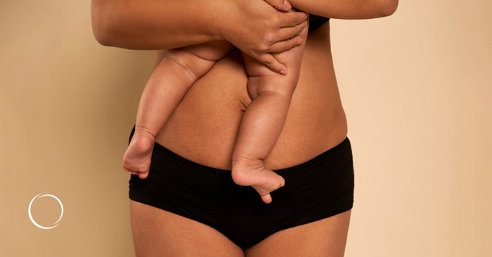 diastasis recti repair restores core strength and abdominal integrity