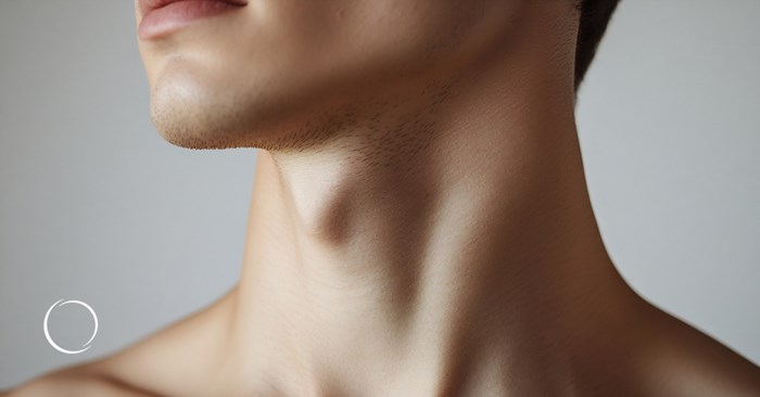 double chin liposuction