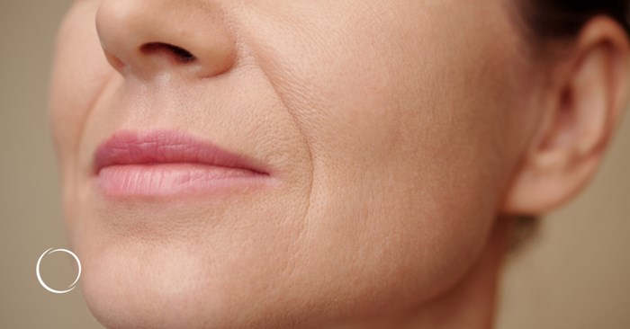 Understanding fat-based fillers: alloClae, Lipoderma, Renuva and more