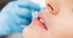 From gloss to surgery: Every lip augmentation option ranked