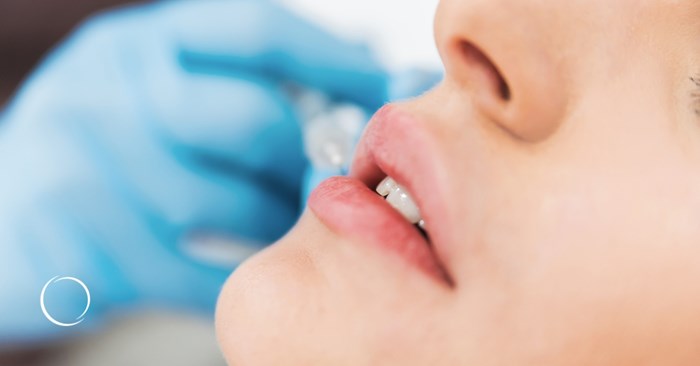 From gloss to surgery: Every lip augmentation option ranked