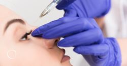 The nonsurgical nose job: Is liquid rhinoplasty for you?