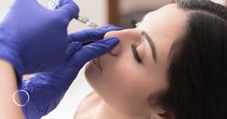 The ideal patient for nonsurgical rhinoplasty