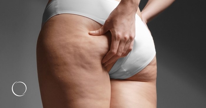 understanding ozempic butt and available treatment options