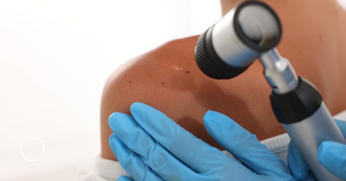 Your partner in skin cancer recovery: How plastic surgeons help restore what's removed