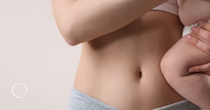 how a tummy tuck can help with separated abdominal muscles
