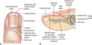 Consult Corner Laceration Through The Nail Bed ASPS Consult Corner Laceration Through The Nail Bed ASPS