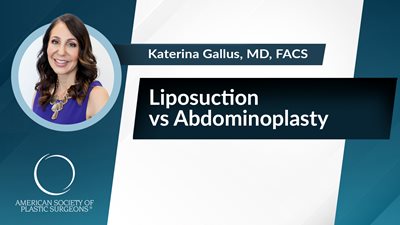 Liposuction vs Abdominoplasty