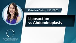 Liposuction vs Abdominoplasty