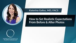 How to Set Realistic Expectations From Before & After Photos