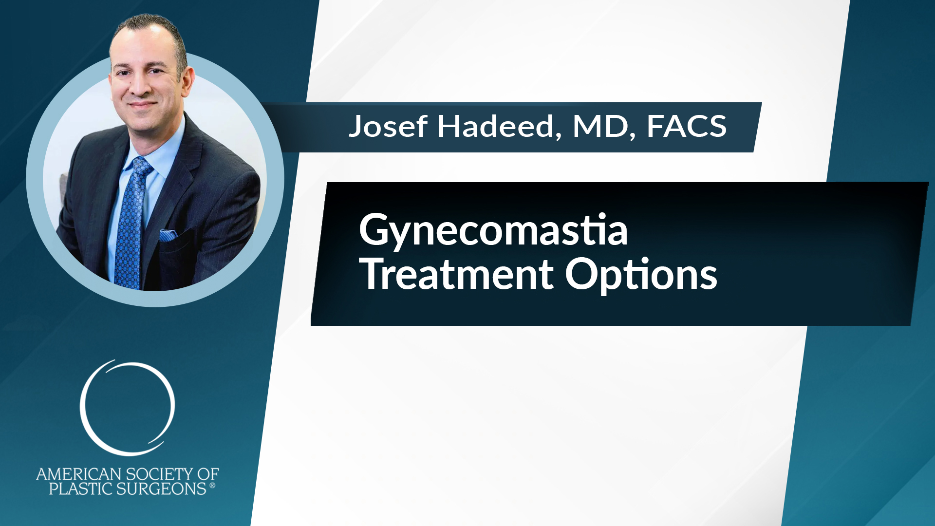 Gynecomastia Treatment Options