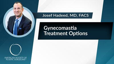 Gynecomastia Treatment Options