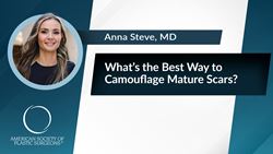 What's the Best Way to Camouflage Mature Scars?